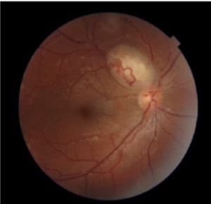 Afshar et al.