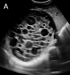 Alshoabi et al. (fig. 1)