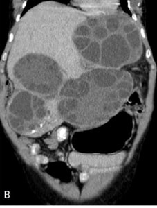 Alshoabi et al. (fig. 2)