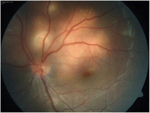 Annamalai et al.