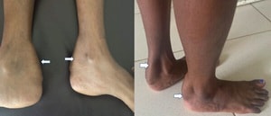 Appuhamy et al.