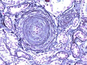 Batal et al.