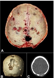 Bitelman et al.