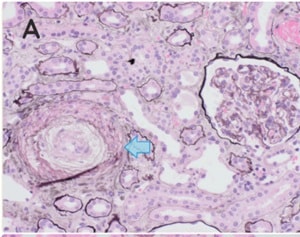 Balatsos et al.