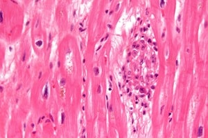 Wikipedia user Nephron (Michael Bonert, MD)