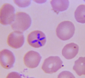 CDC / Dr. R.G. Scholtens