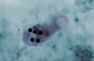 CDC / Dr. Mae Melvin; Dr. Greene