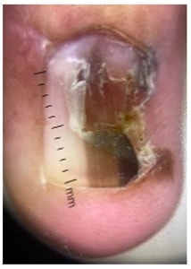 Caraviello et al.