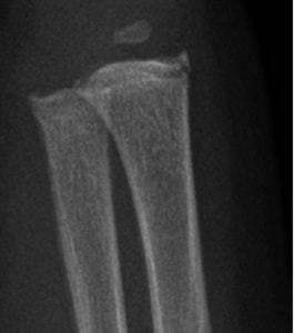 Colleran et al.