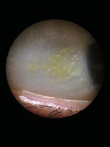 Crum et al.