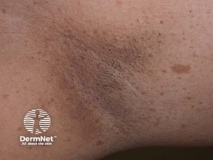 DermNetNZ