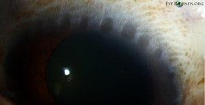 Justin Risma / EyeRounds.org (fig. 1)
