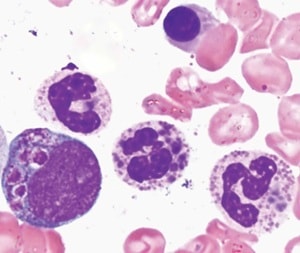 Gopaal et al.
