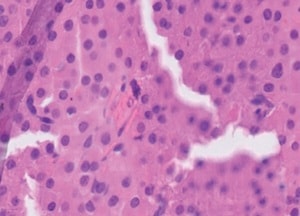 Gretser et al.