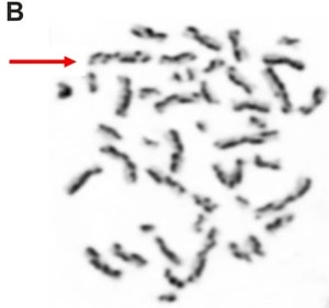 Huson et al.