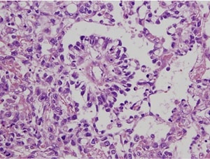 Harano et al.
