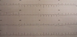 James Hellerman, MD