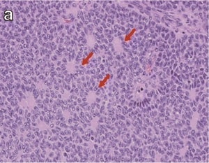 Koganezawa et al.