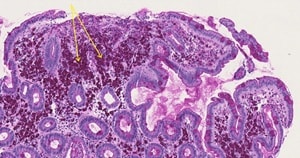 Melas et al.