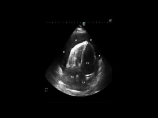 Miravent et al.