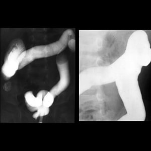 Pediatric Imaging