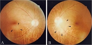 Qin et al.
