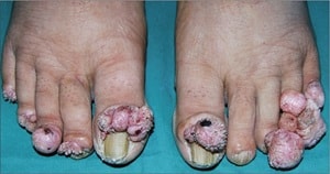Reddy and Somani (fig. 2)