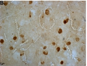 Rohn et al.