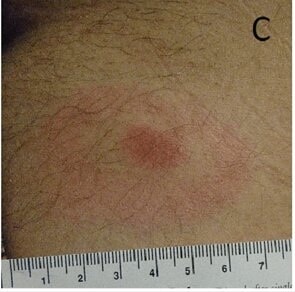 Schotthoefer et al. (fig. 1)