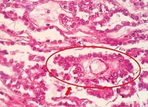 Silva et al.