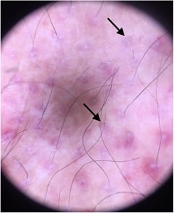 Souza et al.