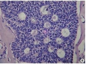 Sumitra et al. (fig. 1)
