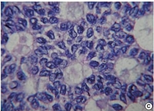 Sumitra et al. (fig. 2)