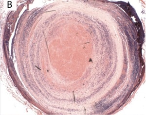 Tobouti et al.