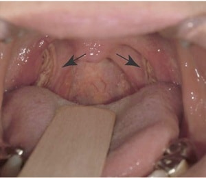Uehara et al.