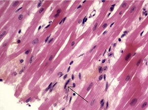 Willaert et al.