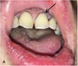 Yang et al. (fig. 1)