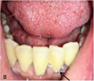 Yang et al. (fig. 2)