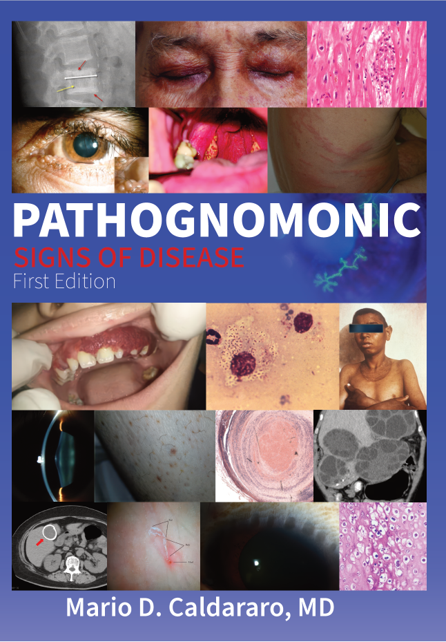 Pathognomonic Signs of Disease — book cover